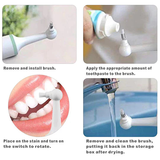 Tooth Plaque Remover | Electric Dental Cleaning Device for Effective Oral Hygiene at Home