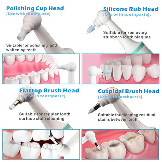 Tooth Plaque Remover | Electric Dental Cleaning Device for Effective Oral Hygiene at Home