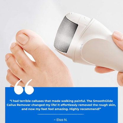 SmoothGlide Callus Remover