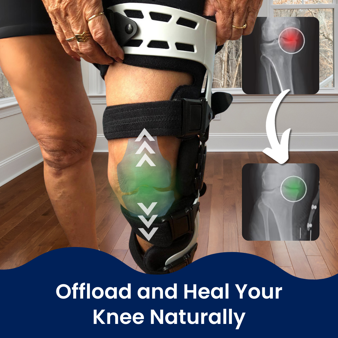 TrueAlign | Knee Brace + 3 FREE Gifts Today