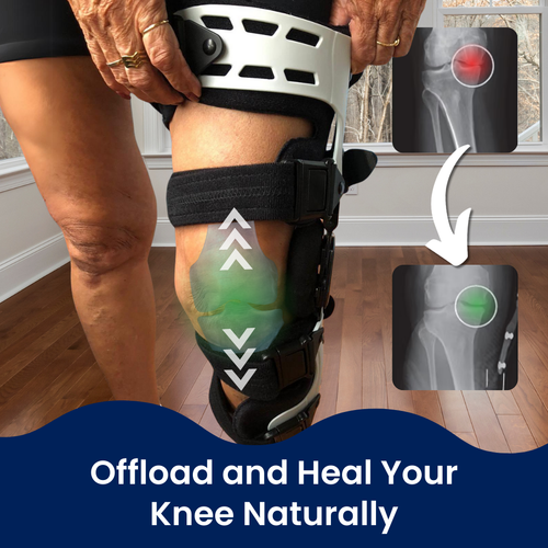 TrueAlign | Knee Brace + 3 FREE Gifts Today