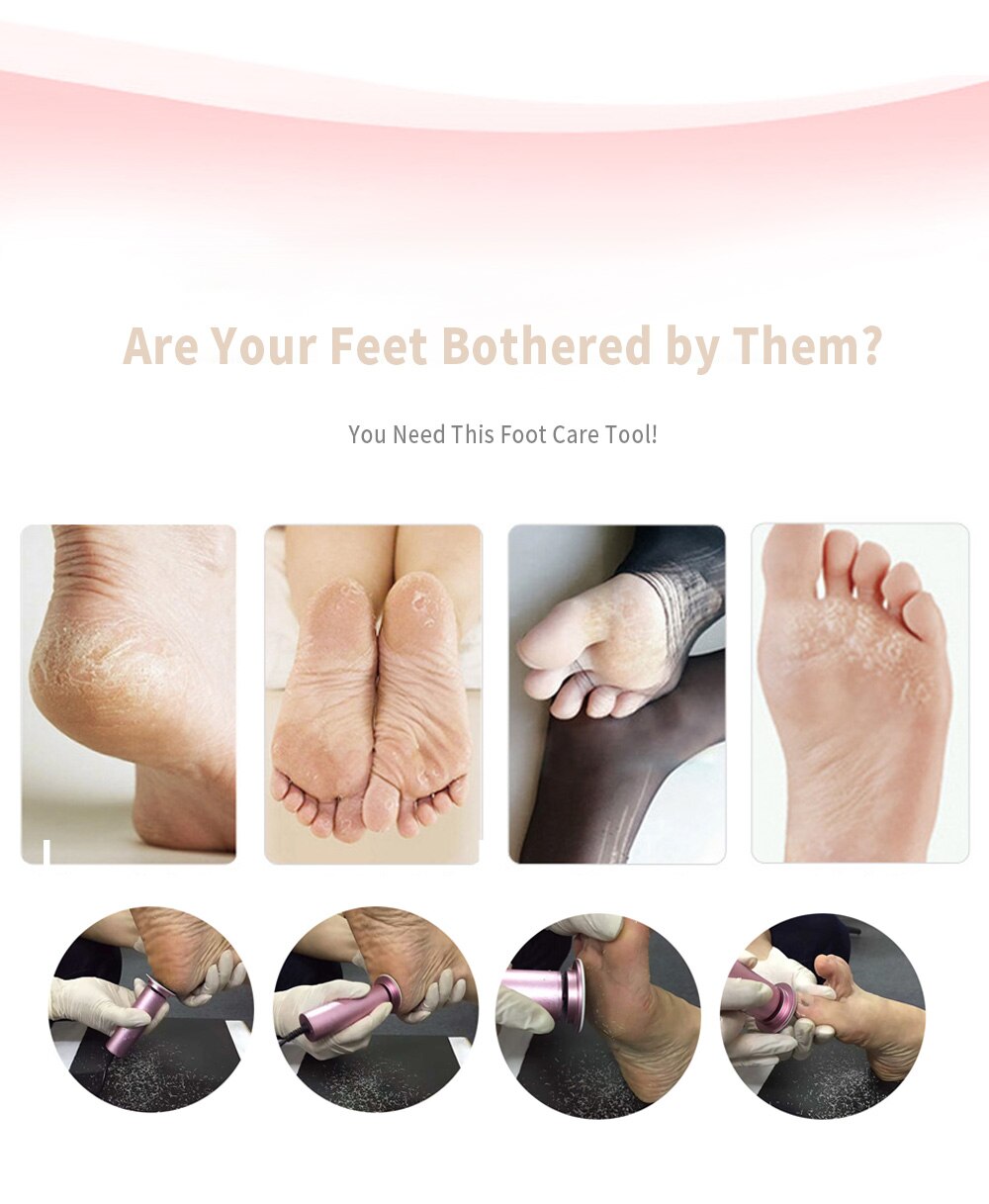 Callus Remover - Foot Callus Remover