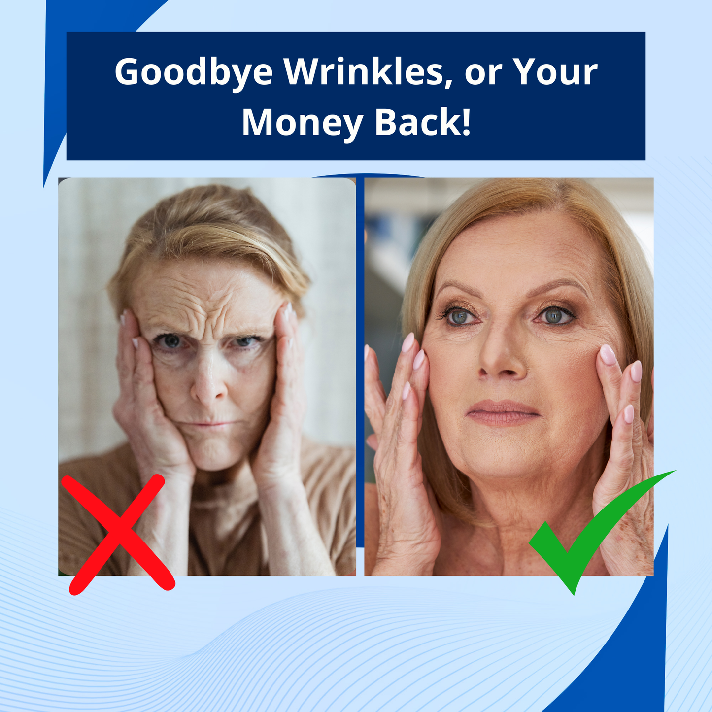 AgeErase Silicone Anti-Wrinkle