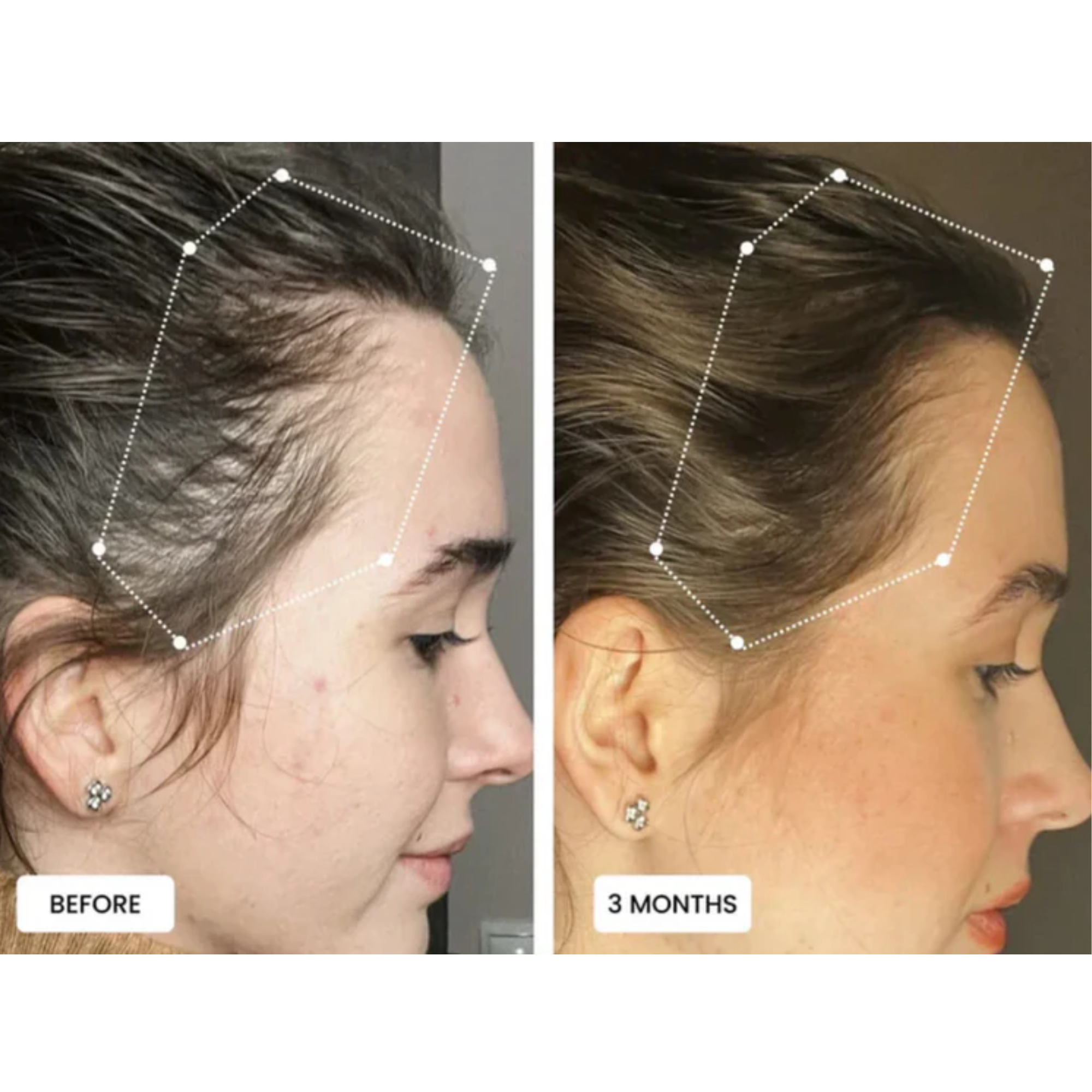 Scalp Massaging Brush with Red Light Therapy | Promotes Hair Growth & Relieves Scalp Tension for Healthier Hair