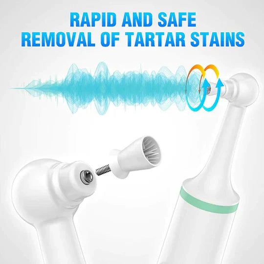 Tooth Plaque Remover | Electric Dental Cleaning Device for Effective Oral Hygiene at Home