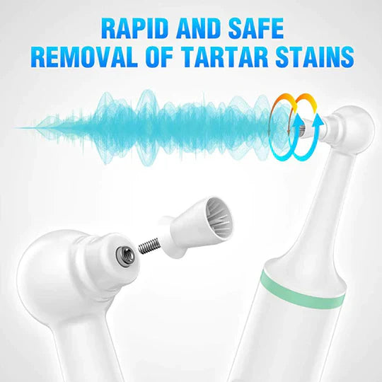 Tooth Plaque Remover | Electric Dental Cleaning Device for Effective Oral Hygiene at Home