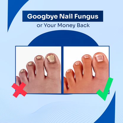 DermalPulse? - Nail Fungus Treatment + 3 FREE Gifts Today