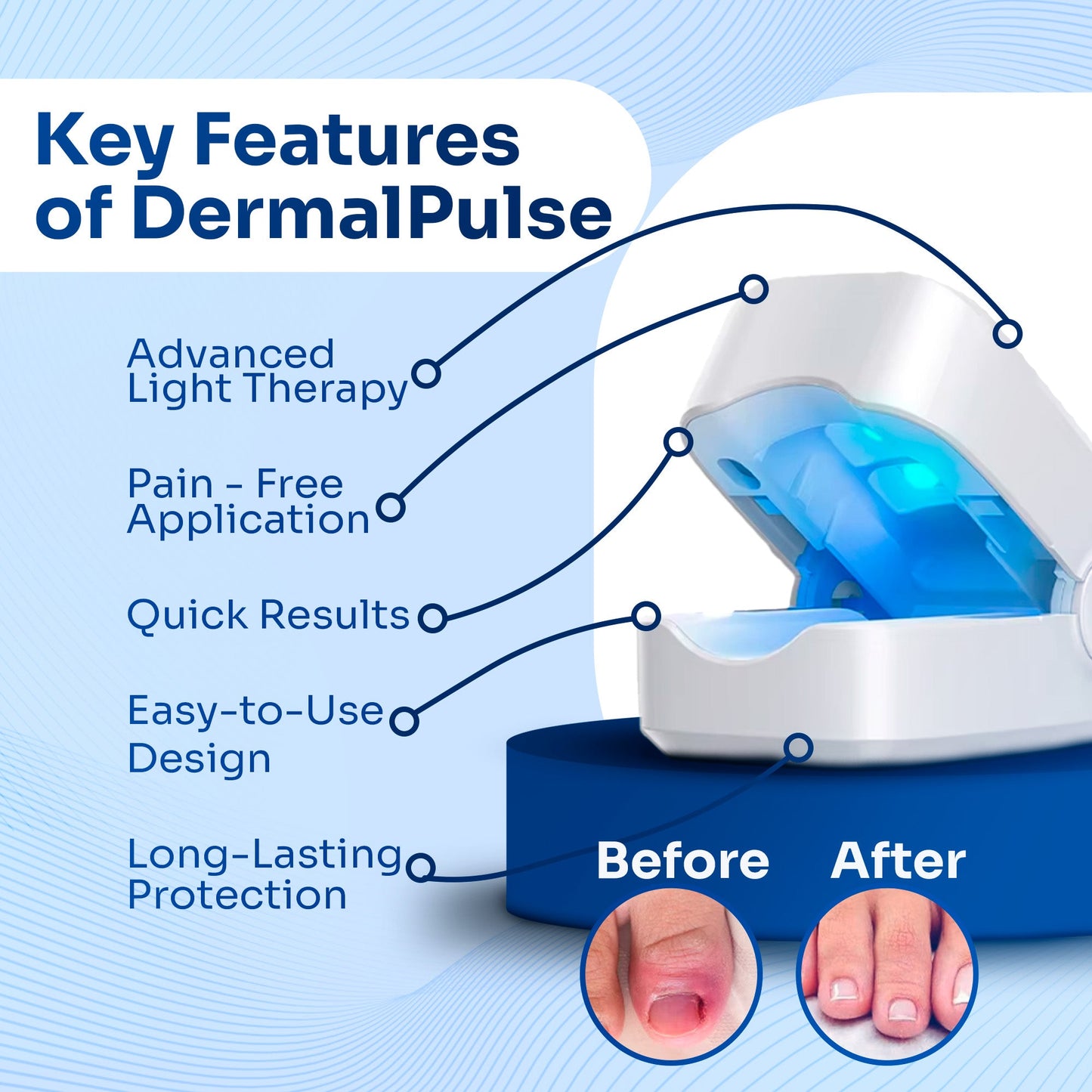 DermalPulse Nail Fungus Treatment