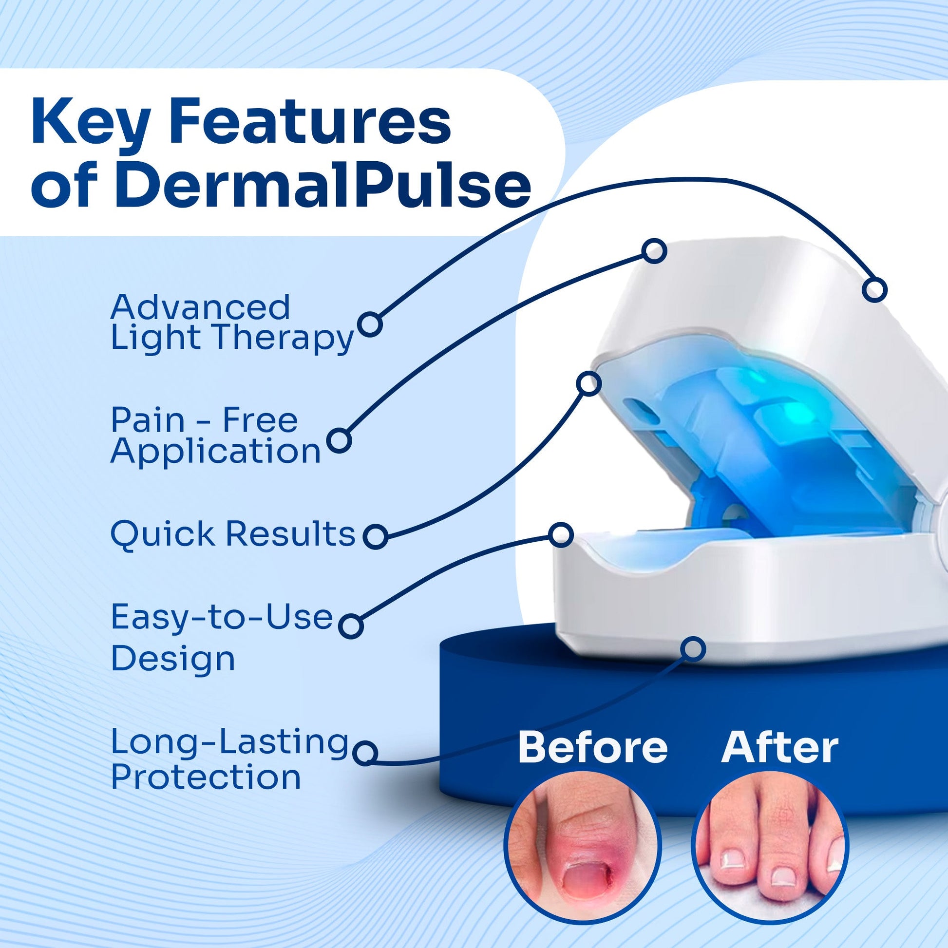 DermalPulse? - Nail Fungus Treatment + 3 FREE Gifts Today