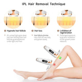 IPL Laser Hair Removal Handset
