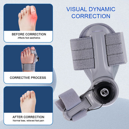 AlignRight Bunion Corrector