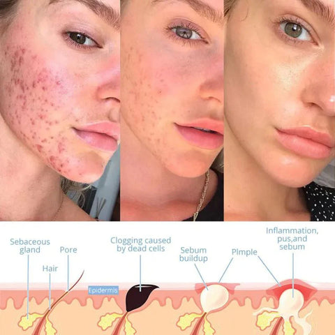 Elysium Glow™ | Professional High-Frequency Facial Wand | Anti-Aging Skin Rejuvenation Device for Home Use & Spa Treatments